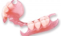 Зубное протезирование – виды протезов и показания для использования