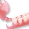 Зубное протезирование – виды протезов и показания для использования