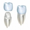 Разновидности зубных коронок