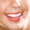Для чего могут понадобиться зубные виниры?