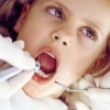 Что необходимо знать о пломбировании зубов