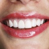 Как правильно выбрать стоматолога? Рекомендации.